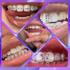 Tooth Gem Kit, DIY Crystals Jewelry Kit Teeth Gems Set, Professional Fashionable Tooth Gems Starter Set